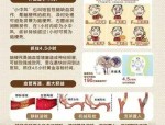 合肥二院卒中绿色通道缩短DNT时间至13分钟，提升医疗服务民生幸福指数